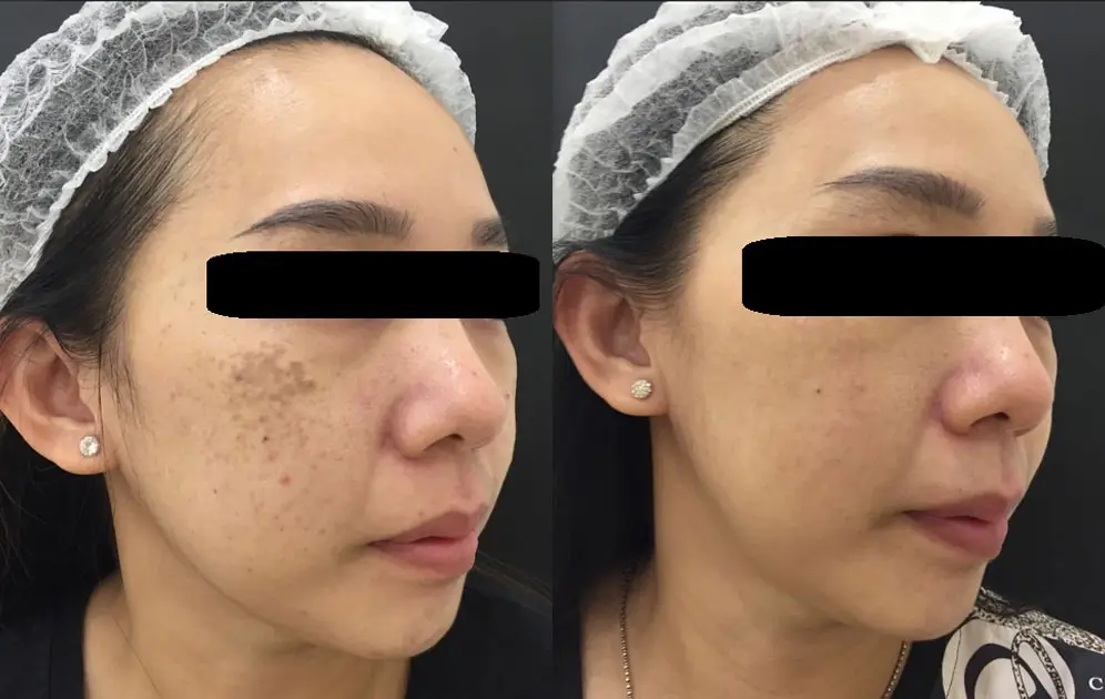 before-after-1.jpg