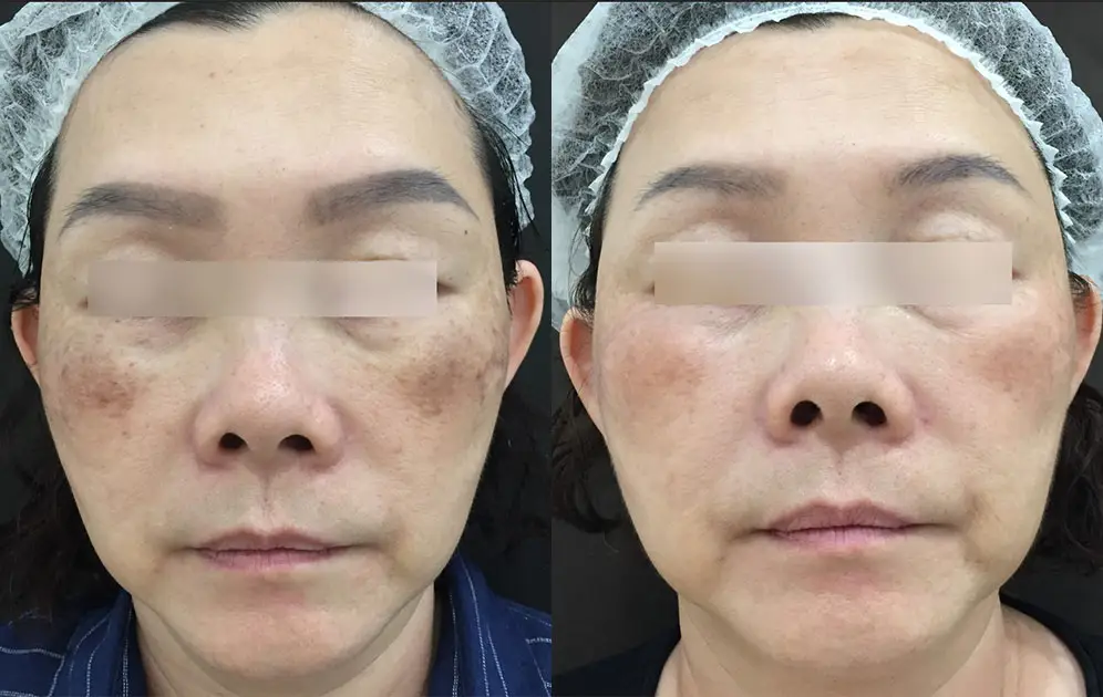 before-after-2.jpg