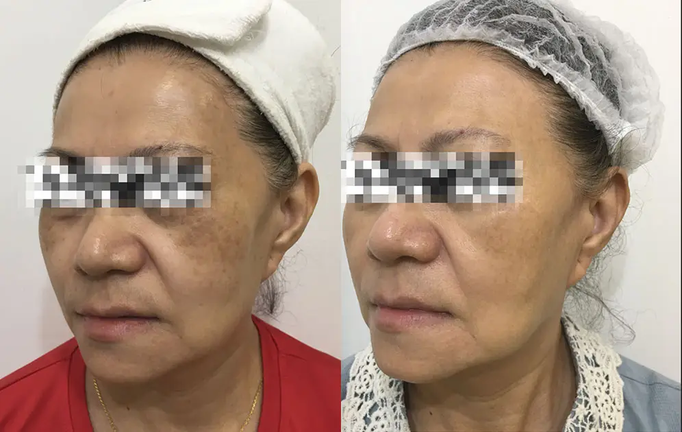before-after-3.jpg