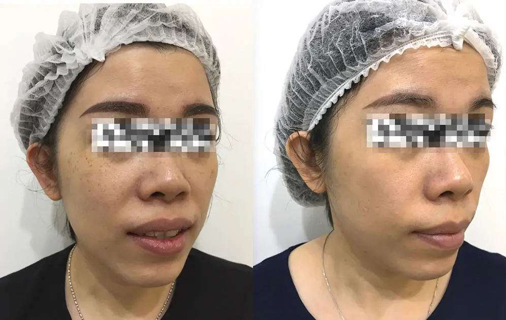 before-after-4.jpg