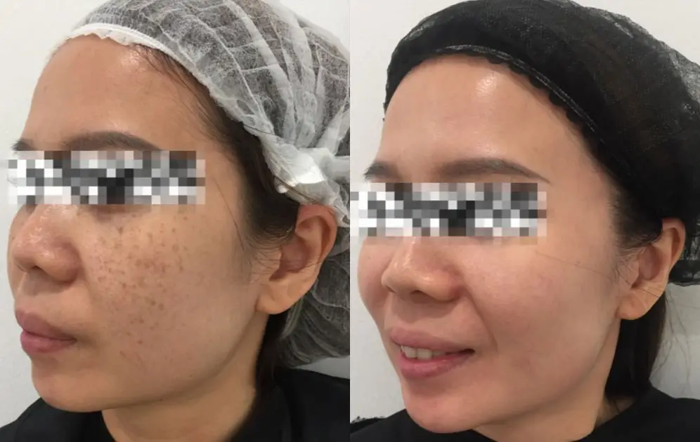 before-after-5.jpg