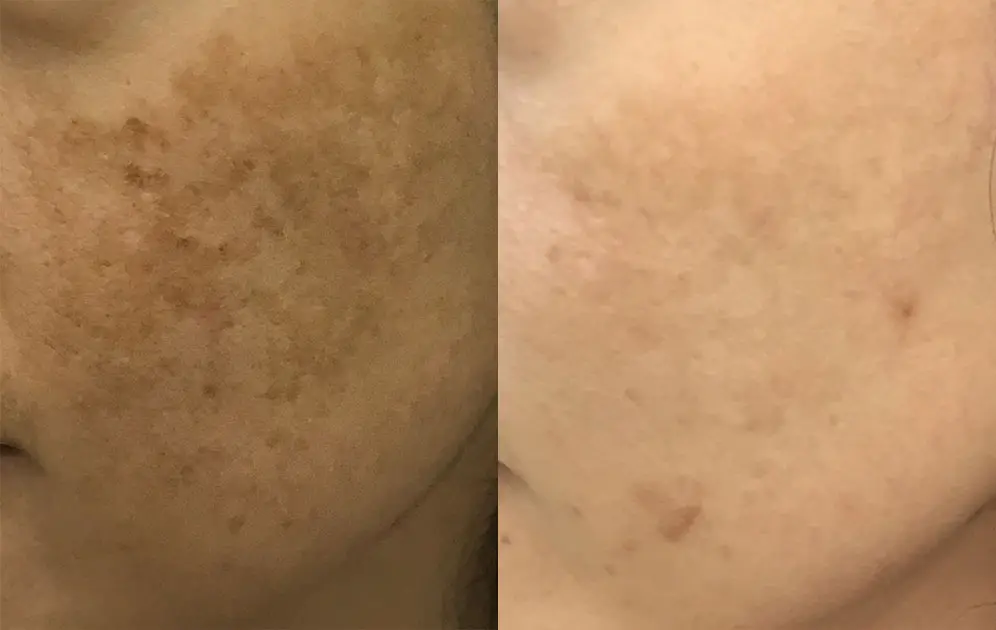 before-after-6.jpg