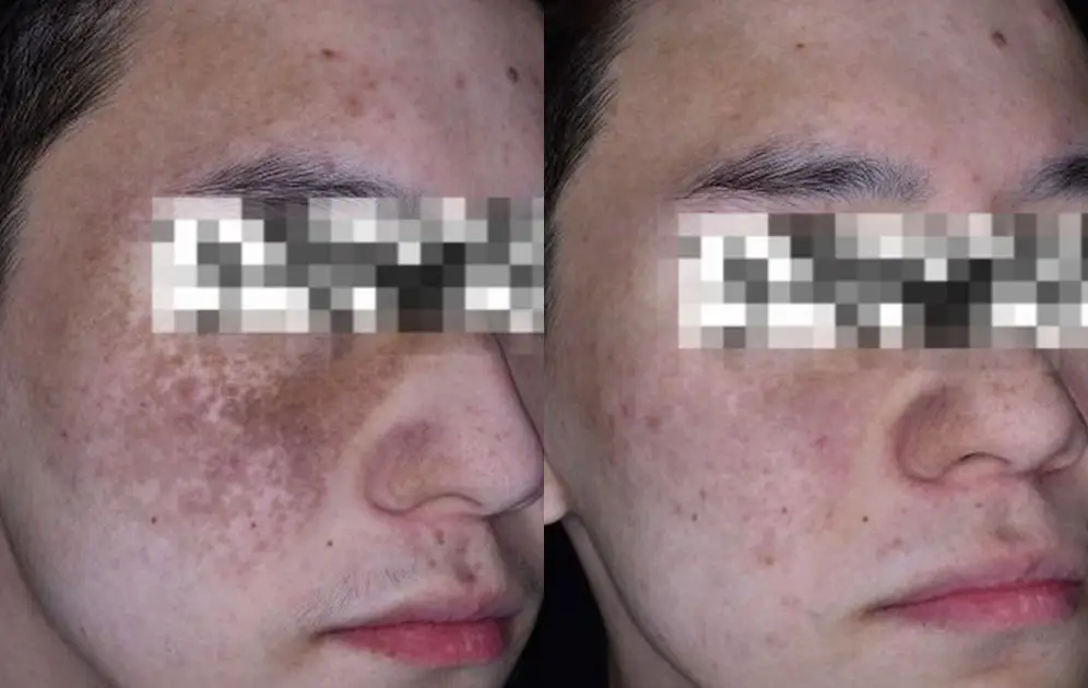 before-after-7.jpg