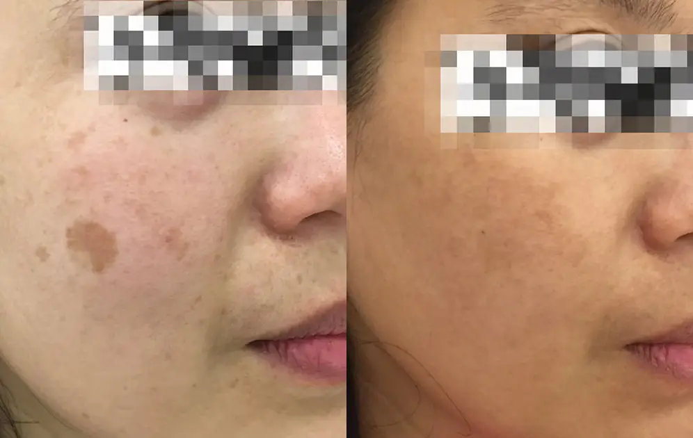 before-after-8.jpg
