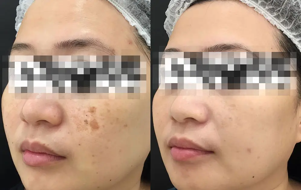 before-after-9.jpg